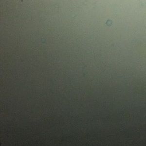 Meet your Posher, Dalton